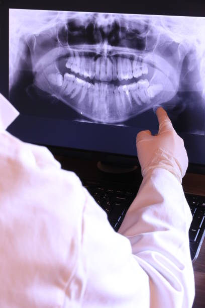 Best Emergency Wisdom Teeth Removal in Arapahoe, NE